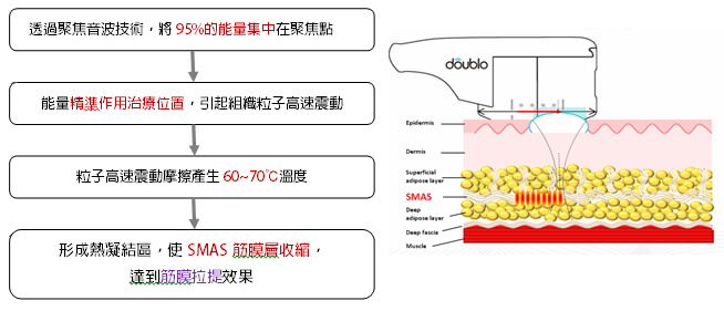 倍提音波拉提