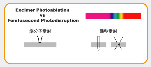 飛秒近視雷射